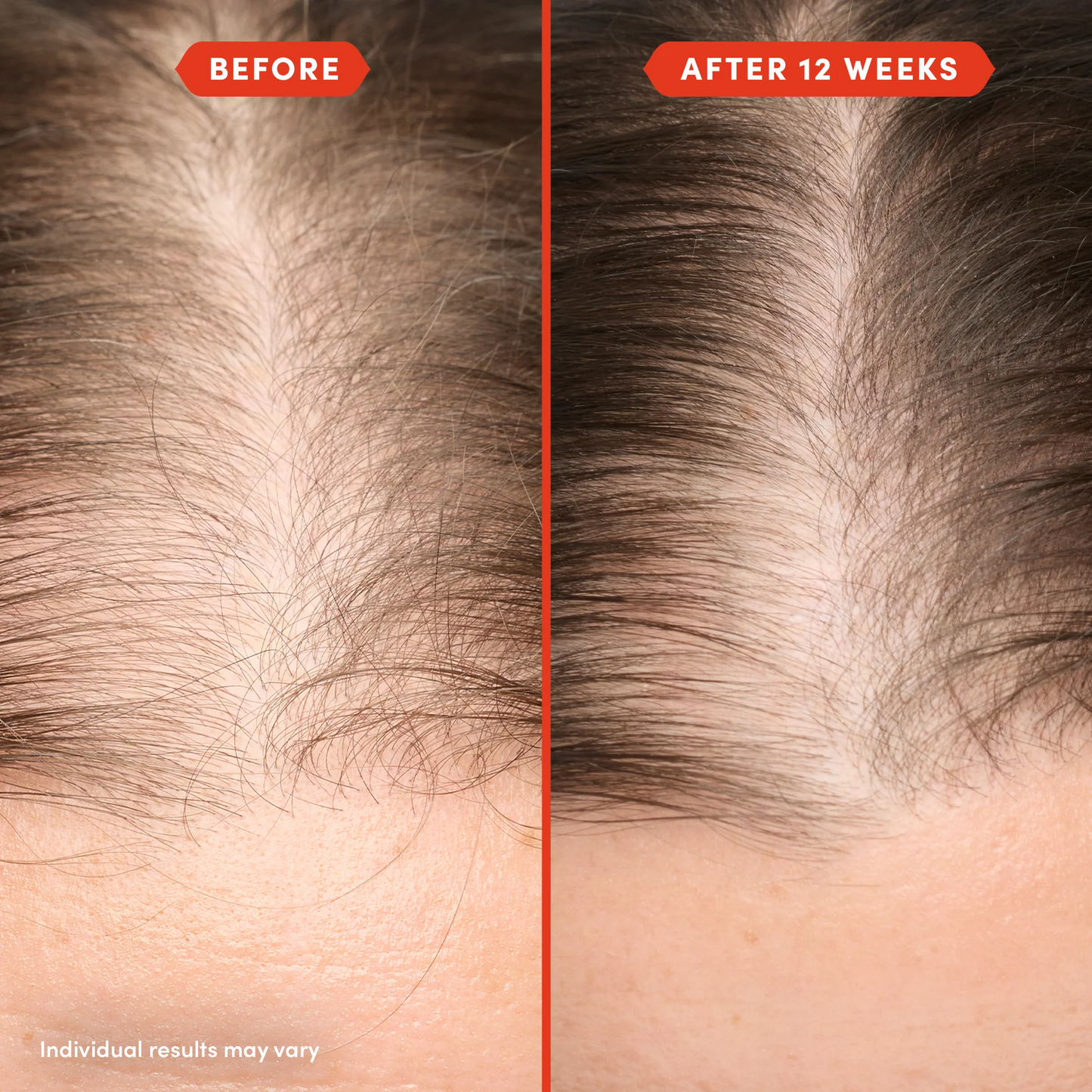 HoliRoots™ Hair Oil