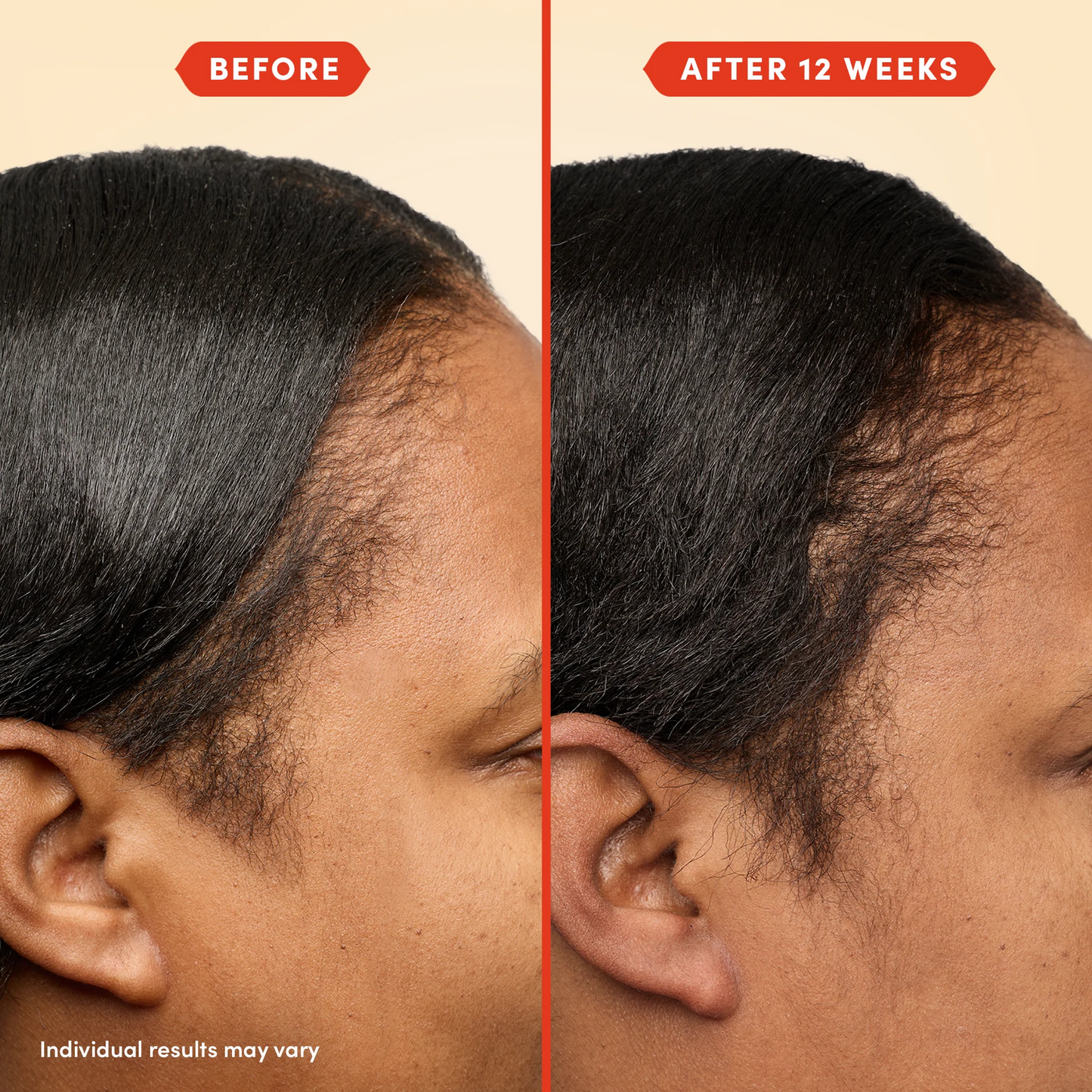 HoliRoots™ Hair Oil